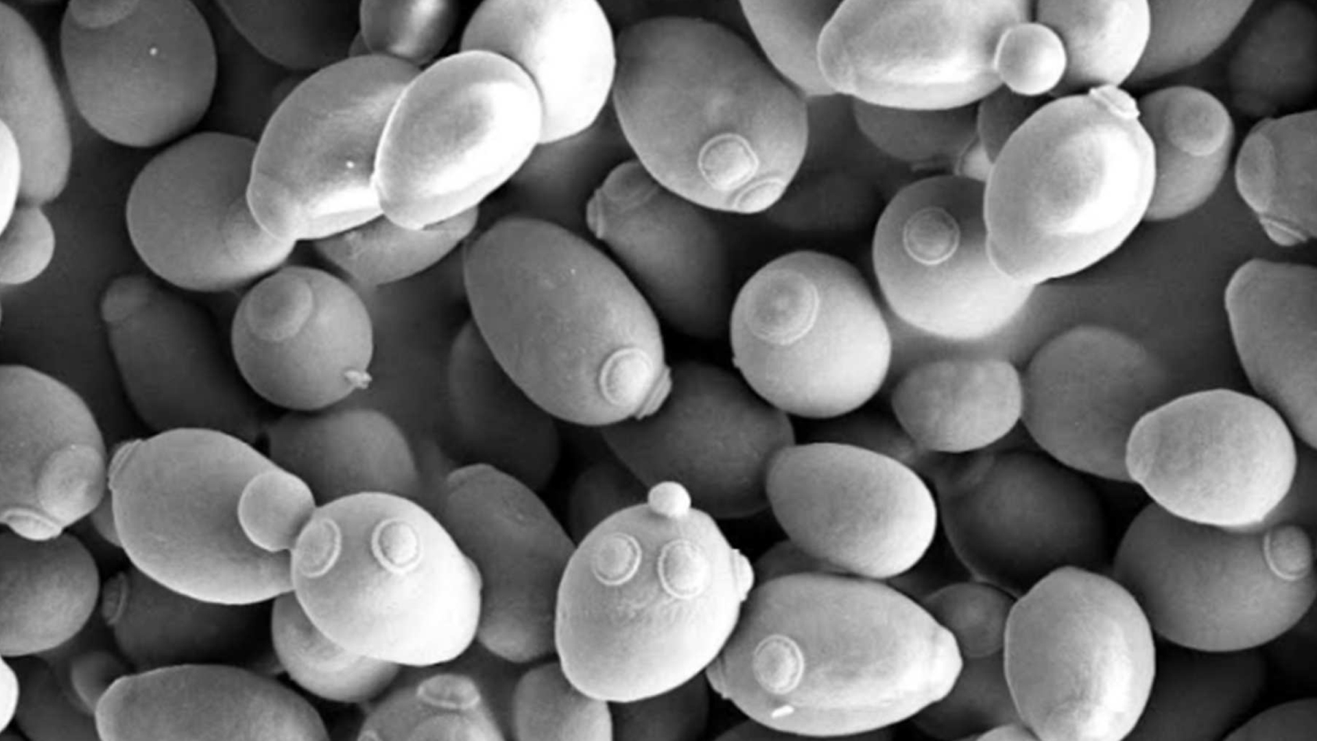 Electron micrograph of yeast cells