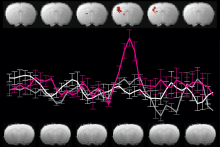 Reevaluating an approach to functional brain imaging