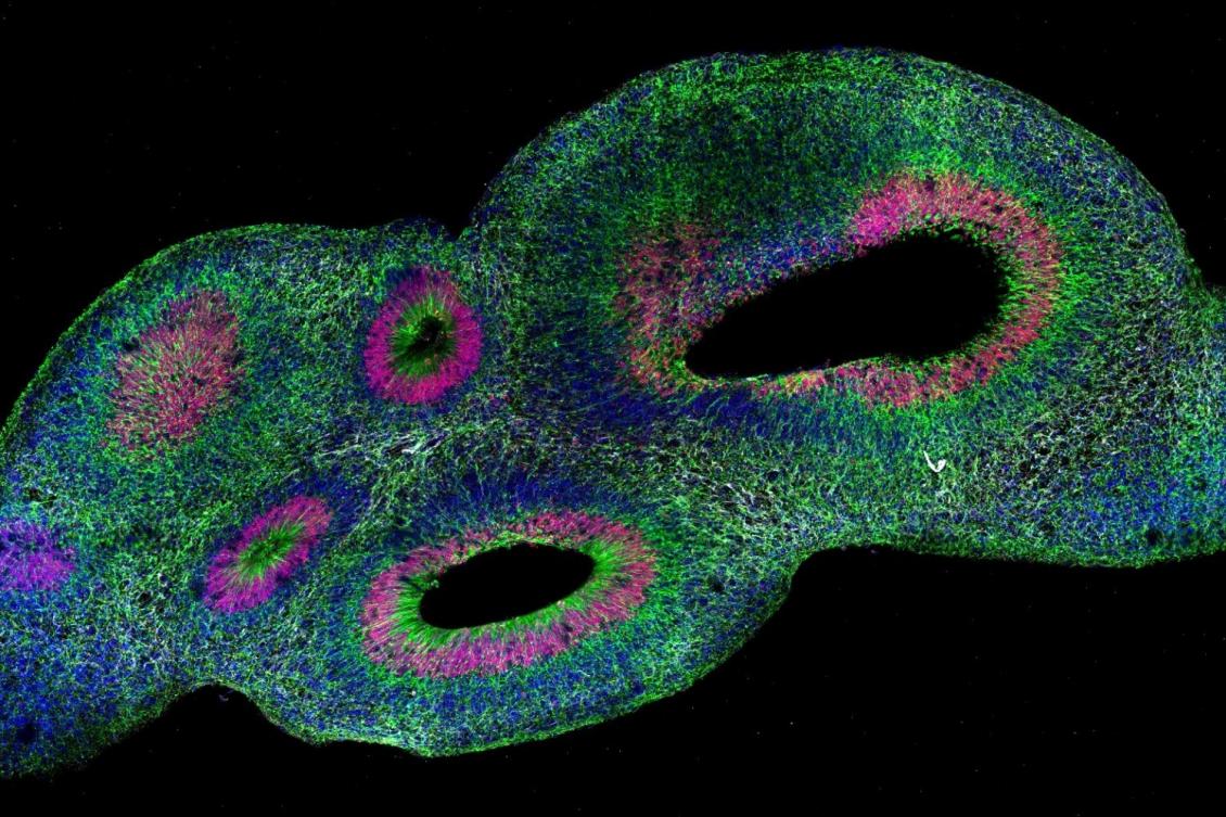 “SCOUT” helps researchers find, quantify significant differences among organoids