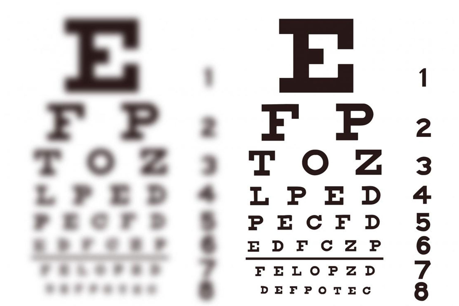 side by side eye charts, one is blurry