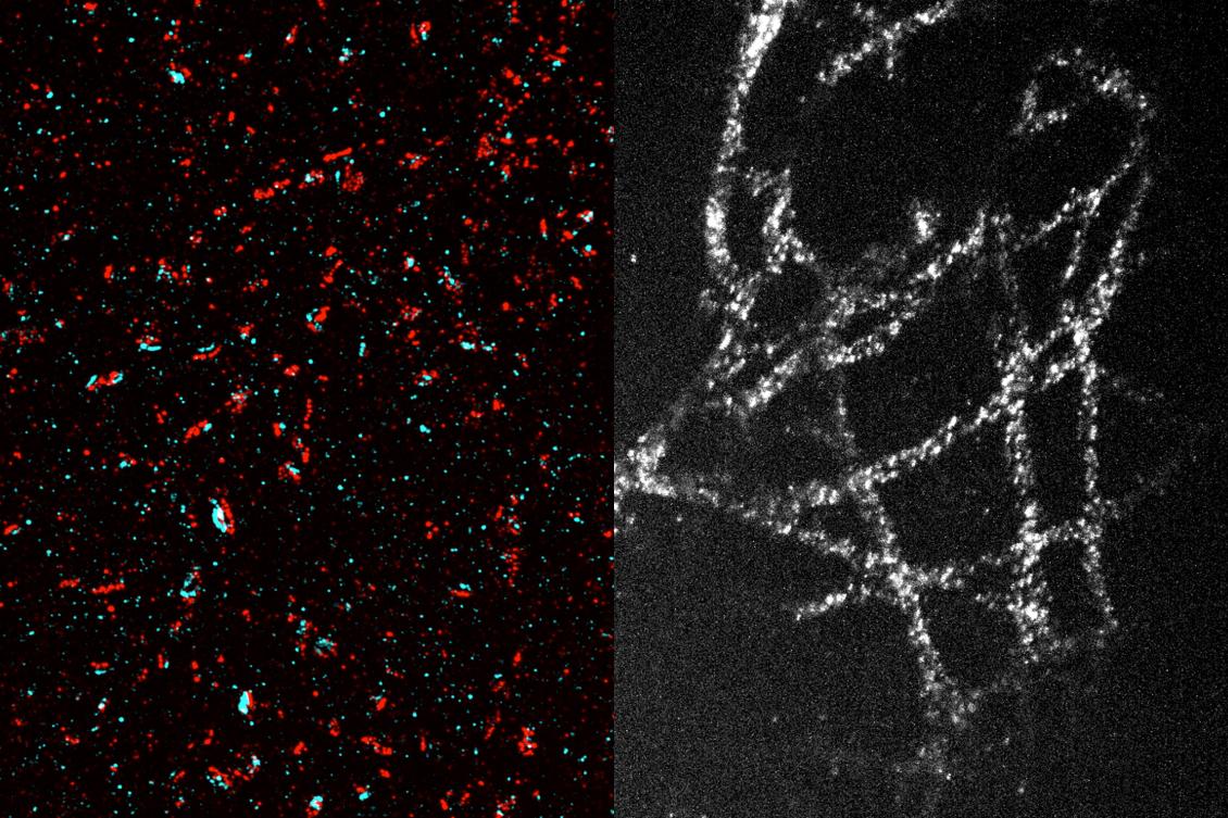 Thanks to a new technique that allows them to expand tissue 20-fold before imaging it, MIT researchers used a conventional light microscope to generate high-resolution images of synapses (left) and microtubules (right). In the image at left, presynaptic proteins are labeled in red, and postsynaptic proteins are labeled in blue. Each blue-red “sandwich” represents a synapse.