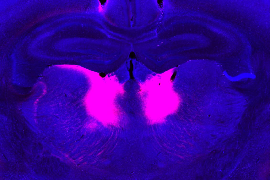 MIT researchers have identified neurons in the mediodorsal thalamus (labeled pink) whose dysfunction can lead to impairments in the ability to update beliefs based on new information.