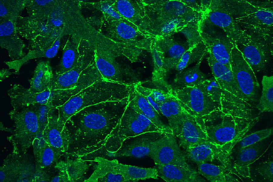 MIT scientists investigated how genetic mutations that cause the disorder Rett syndrome affect the brain’s blood vessels. The Rett syndrome endothelial cells seen here showed less expression of ZO-1 (green), a key protein for forming a tight seal in blood vessels, than control cells (not pictured).