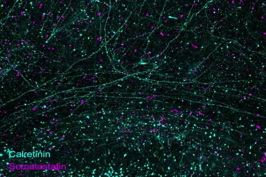 An MIT-led team has developed a series of technologies to image and analyze the brain at scales ranging from a whole brain hemisphere down to individual neural connections and proteins. In this still frame from a video (see below), two kinds of neurons (calretinin-expressing in cyan and somatostatin-expressing in magenta) are visible in the prefrontal cortex of a human brain.