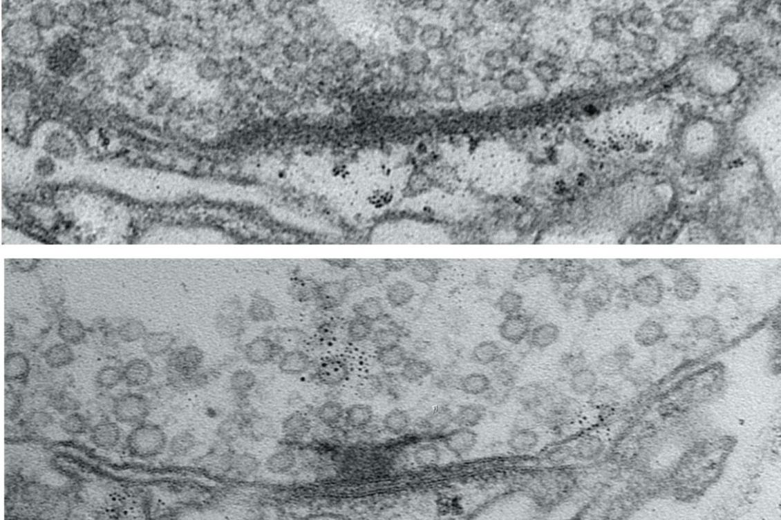 These images show how synapses formed between a neuron (above) and muscle (below) a narrow cleft.