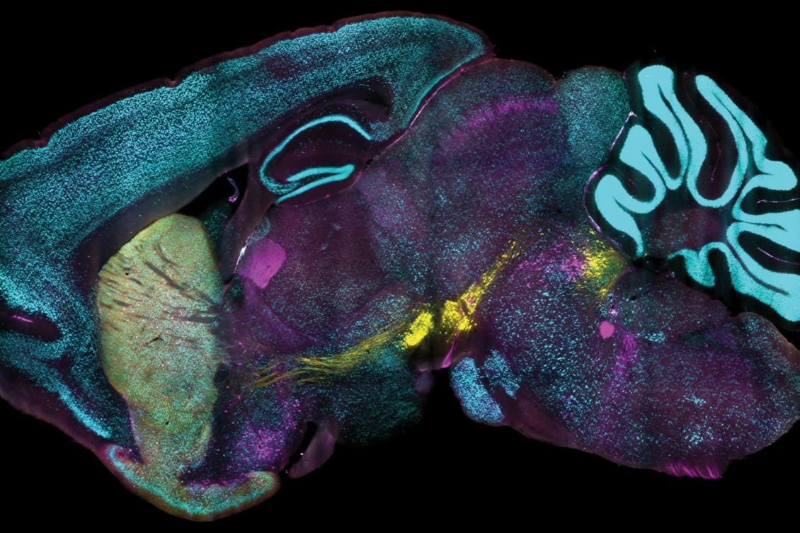 mouse brain proteins