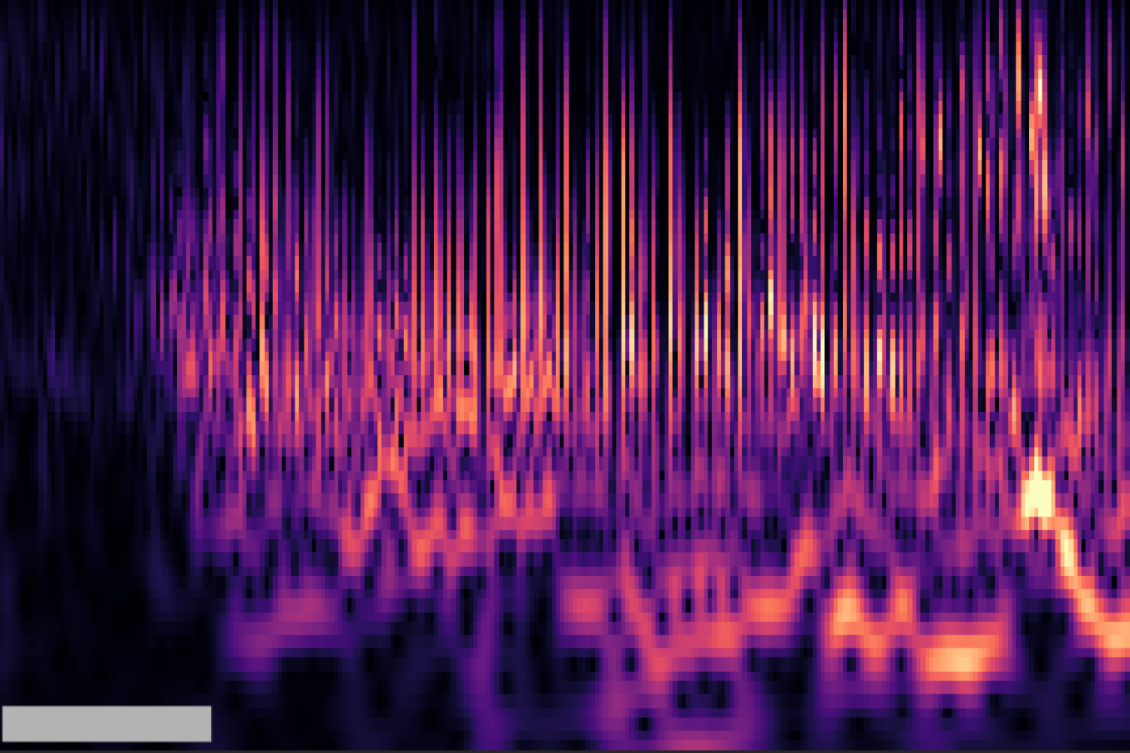 In hope of finding a thalamic stimulation current level that wouldn't trigger seizures, researchers progressively titrated current (horizontal axis).