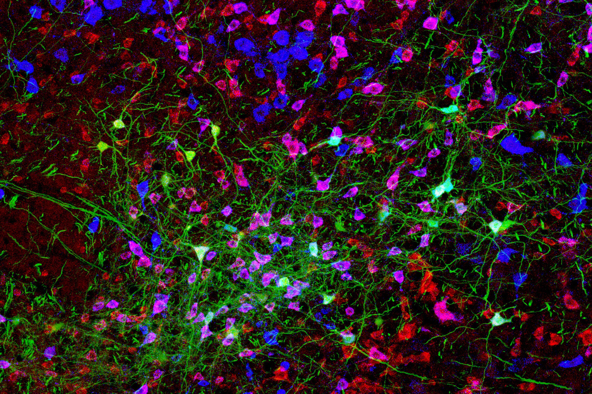 MIT neuroscientists discovered the mechanism underlying the oscillator circuit that controls the rhythmic extension and retraction of whiskers in mice.