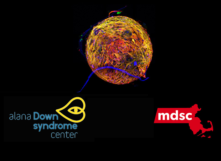 Building a Better Tomorrow for Down Syndrome Through Research and Technology