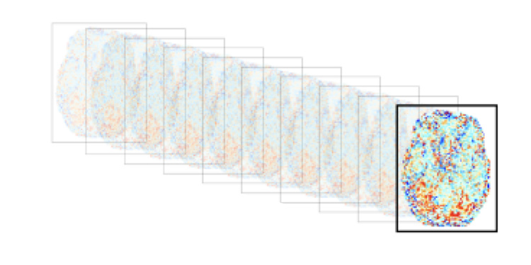 BCS Computational Tutorial - GLMsingle: a toolbox for improving single-trial fMRI response estimates