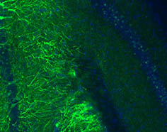 SfN 161113 Graphic - email.jpg