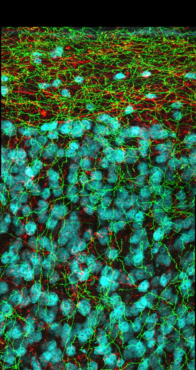 linden axons.jpeg