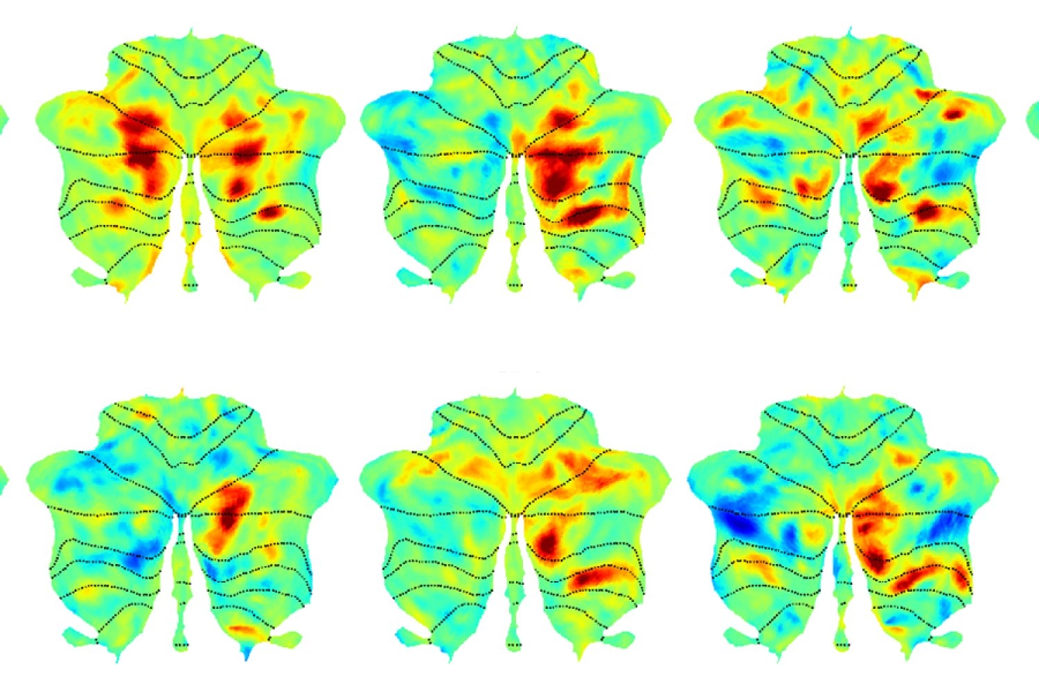 A satellite language network in the brain | Brain and Cognitive Sciences