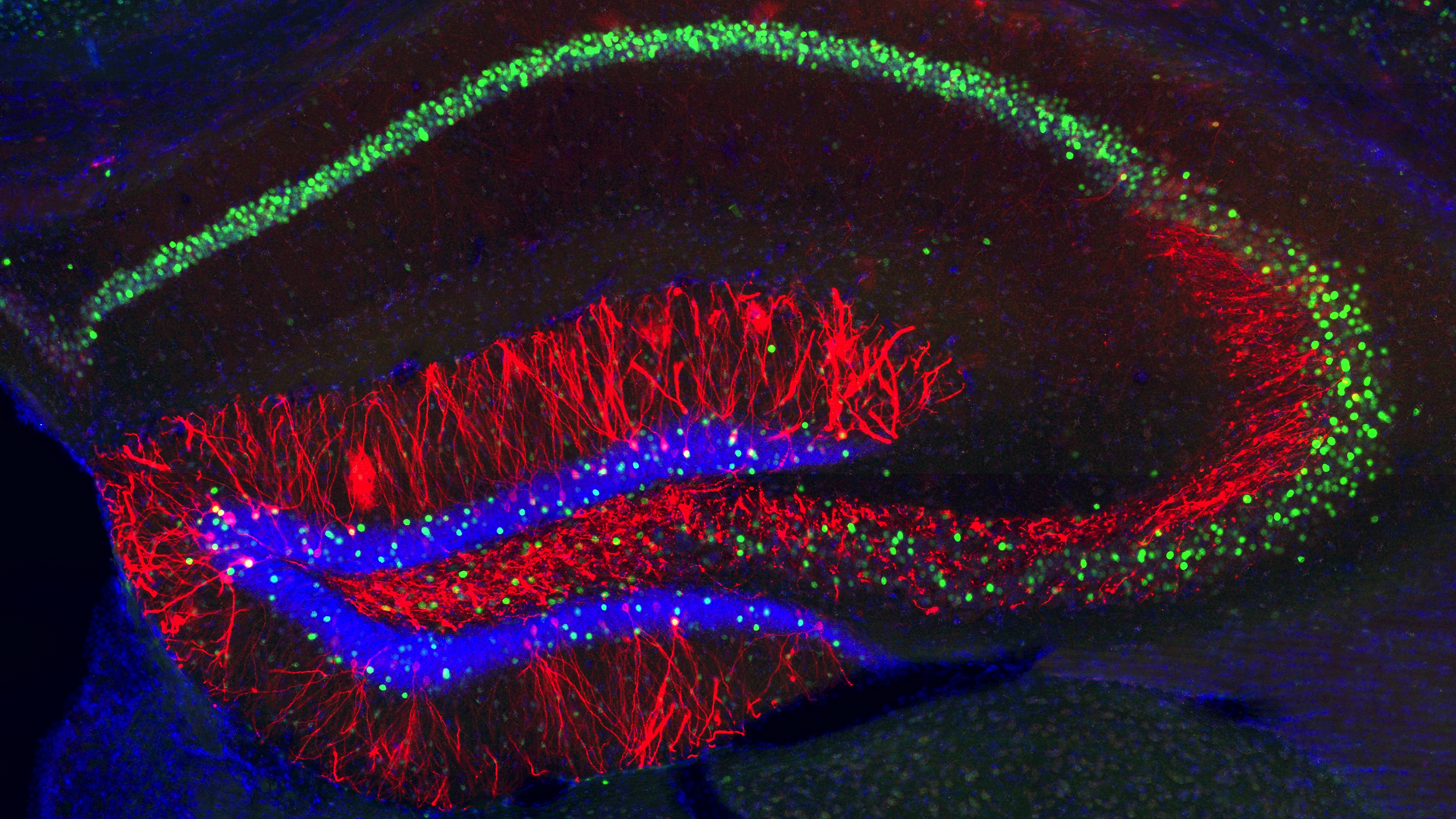 An image of hippocampal stained with red, blue, and green markers