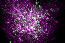 Rett syndrome study highlights potential for personalized treatments