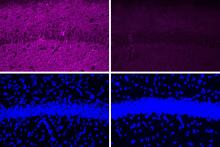 A new peptide may hold potential as an Alzheimer’s treatment