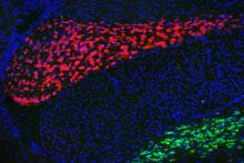 Some brain disorders exhibit similar circuit malfunctions