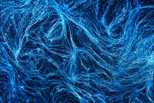 How microglia contribute to Alzheimer’s disease