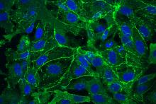 Scientists discover genetics behind leaky brain blood vessels in Rett syndrome