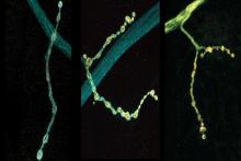Individual neurons mix multiple RNA edits of key synapse protein, study finds