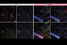 Seeing more in expansion microscopy