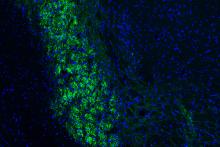 The brain’s internal ruler