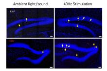 In Down syndrome mice, 40Hz light and sound improve cognition, neurogenesis, connectivity