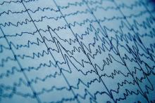 Electric fields help guide neural activity, even from moment to moment