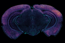 How sensory gamma rhythm stimulation clears amyloid in Alzheimer’s mice