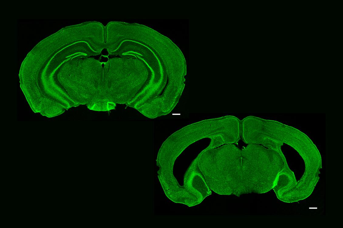 Brain’s “memory center” is needed to recognize image sequences, but not single sights