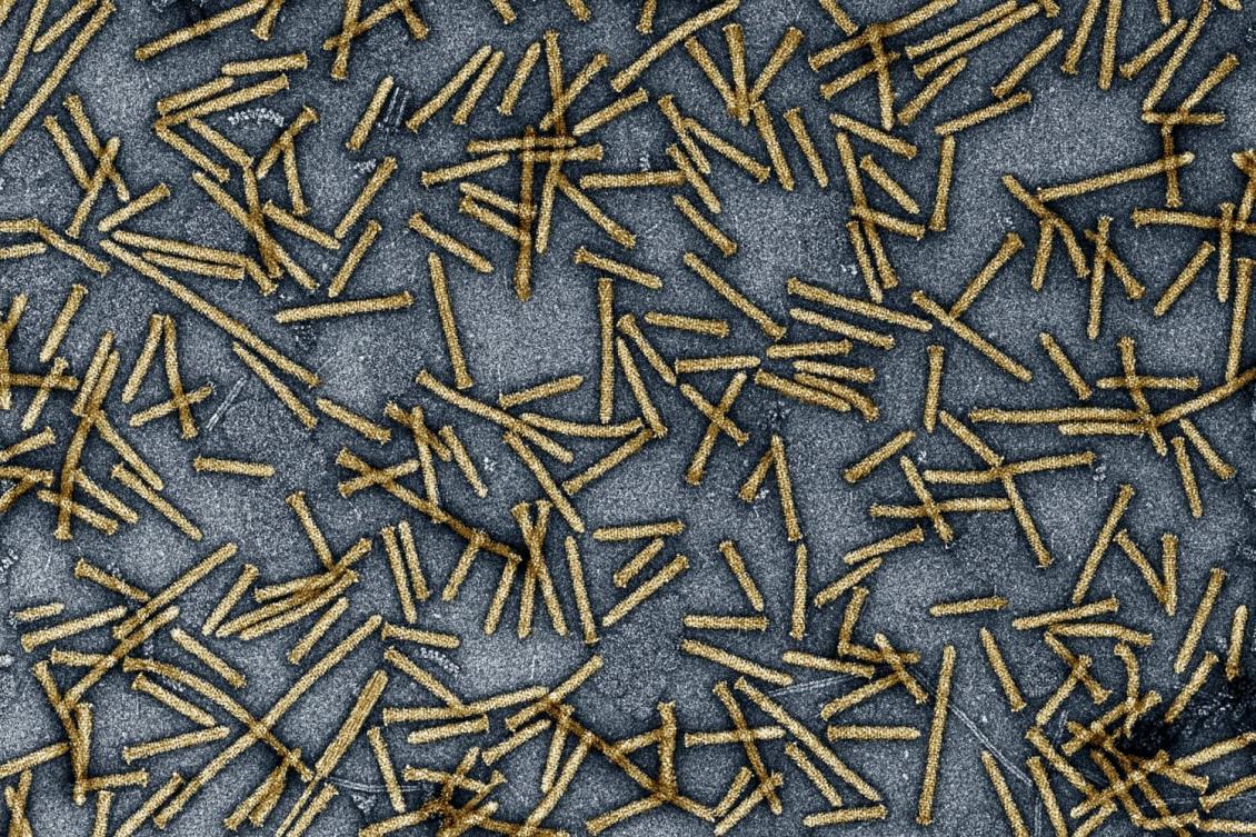 Bacterial injection system delivers proteins in mice and human cells Bacterial injection system delivers proteins in mice and human cells