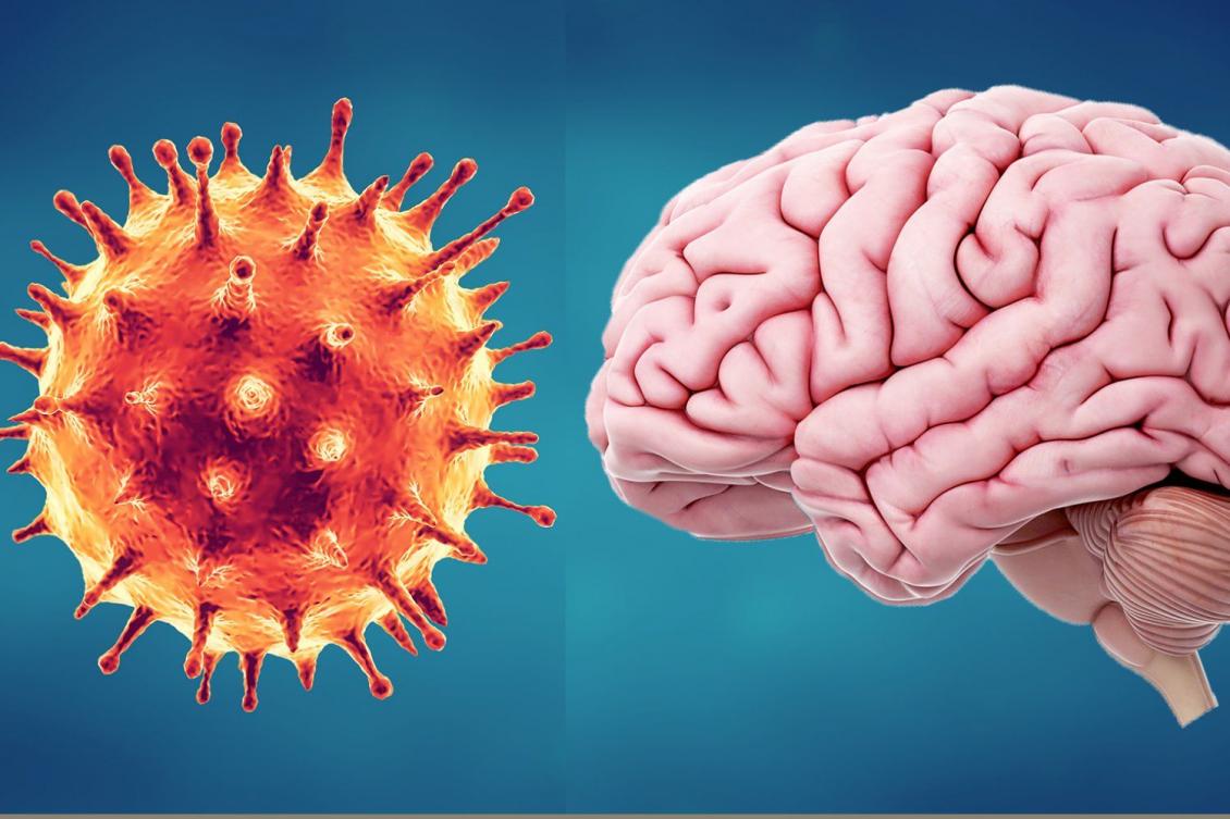 Covid-brain-crop.jpg Covid-brain-crop.jpg