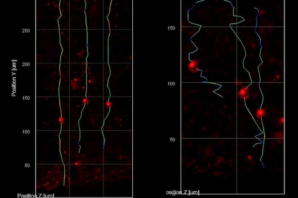 Advanced imaging reveals mired migration of neurons in Rett syndrome lab models