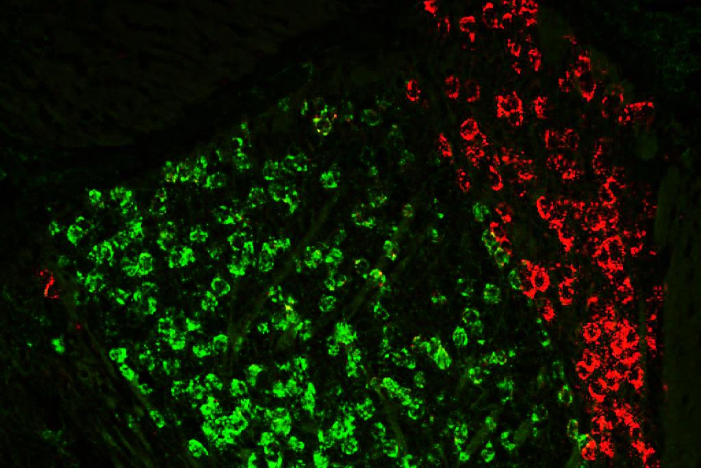 A brain circuit in the thalamus helps us hold information in mind A brain circuit in the thalamus helps us hold information in mind