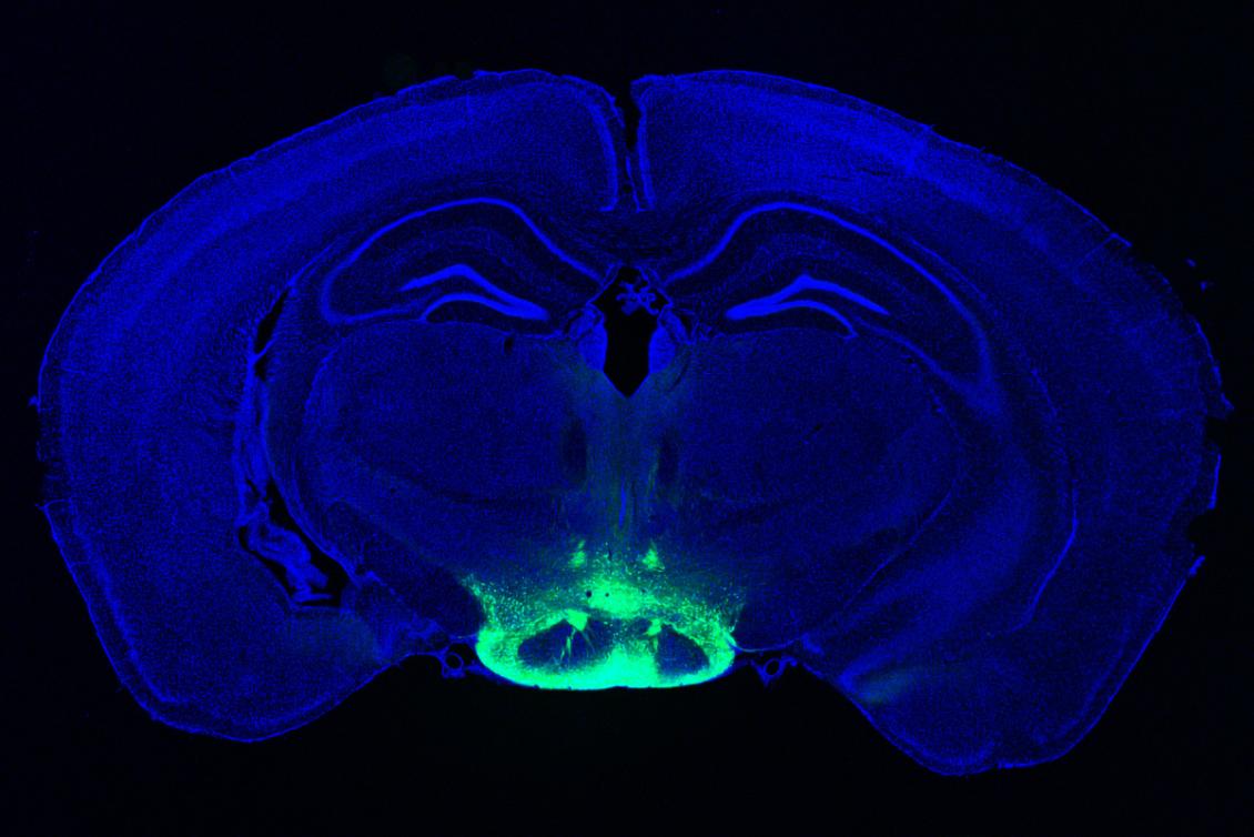 Neuroscientists identify cells especially vulnerable to Alzheimer’s