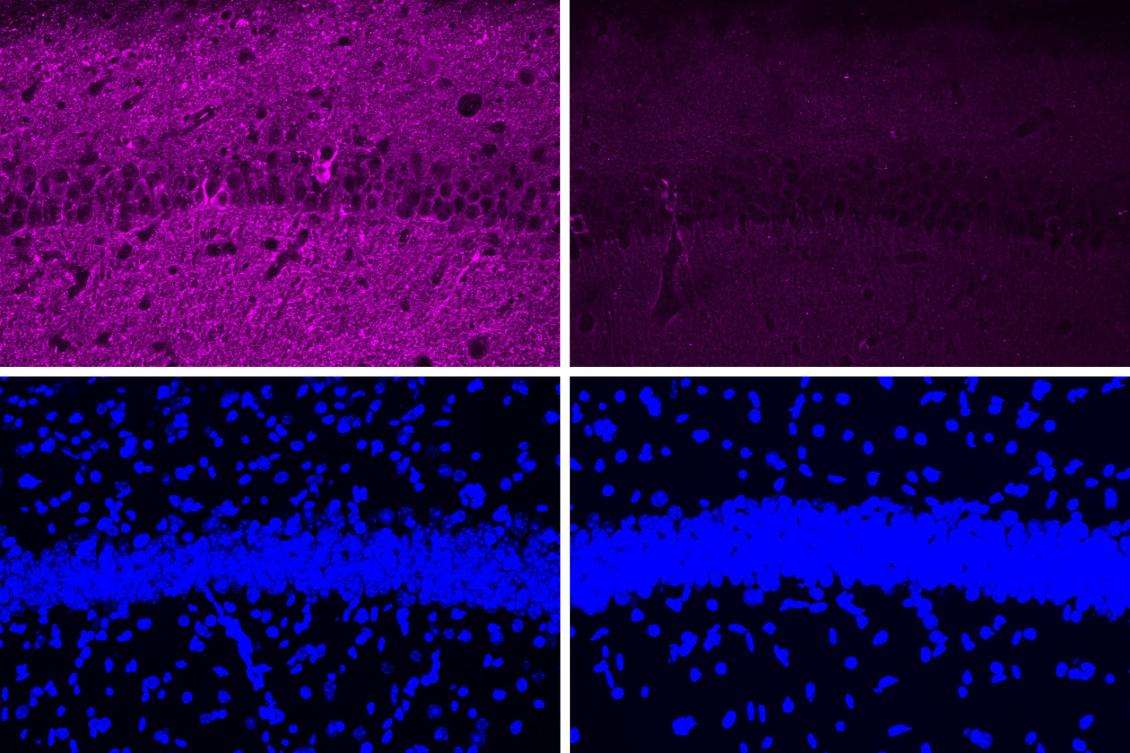 A new peptide may hold potential as an Alzheimer’s treatment A new peptide may hold potential as an Alzheimer’s treatment
