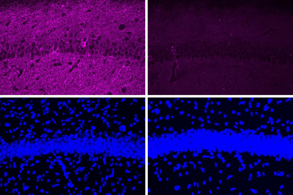 A new peptide may hold potential as an Alzheimer’s treatment