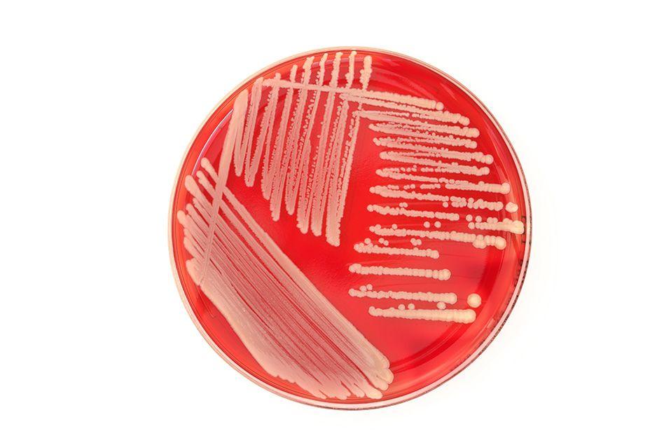 MIT-Bacterial-Colony.jpg