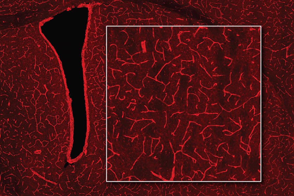 Using MRI, engineers have found a way to detect light deep in the brain