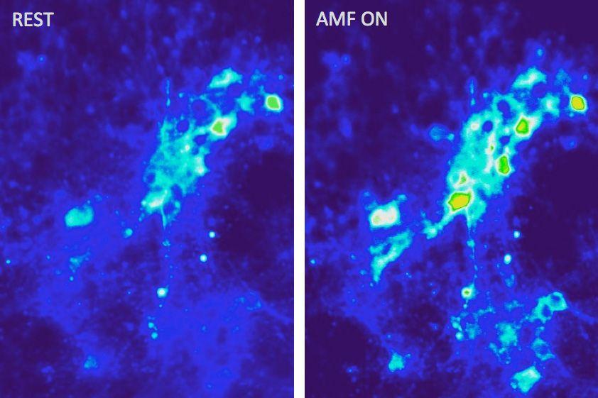 MIT-Brain-Particles-01.jpg