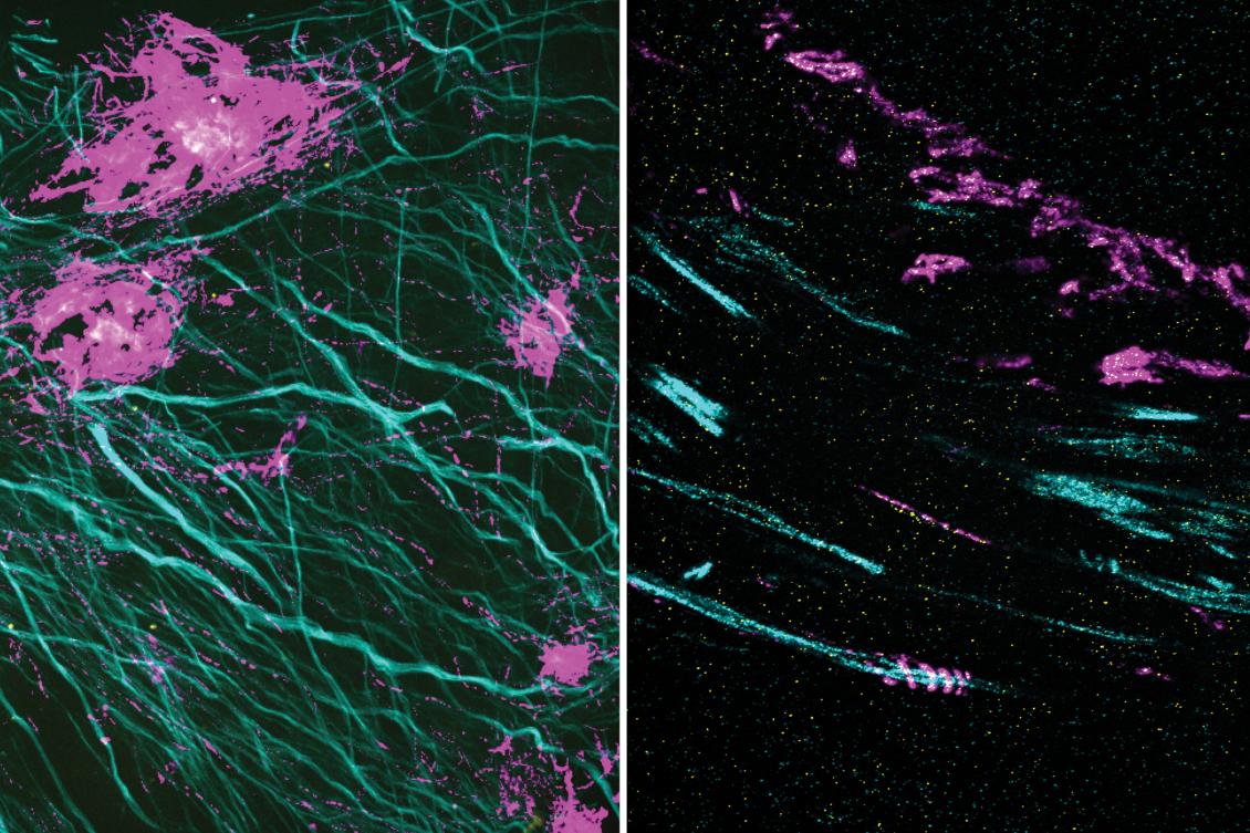 Microscopy technique reveals hidden nanostructures in cells and tissues Microscopy technique reveals hidden nanostructures in cells and tissues