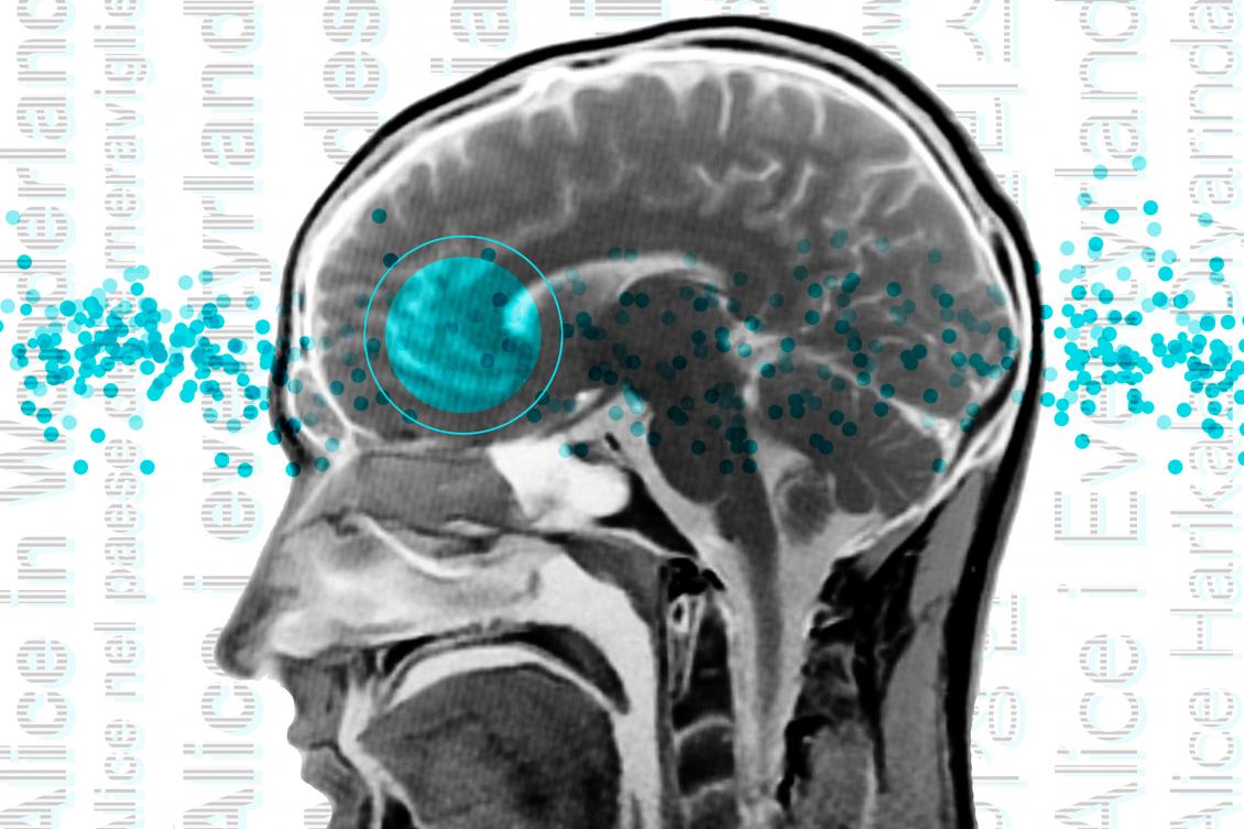 Whether speaking Turkish or Norwegian, the brain’s language network looks the same Whether speaking Turkish or Norwegian, the brain’s language network looks the same