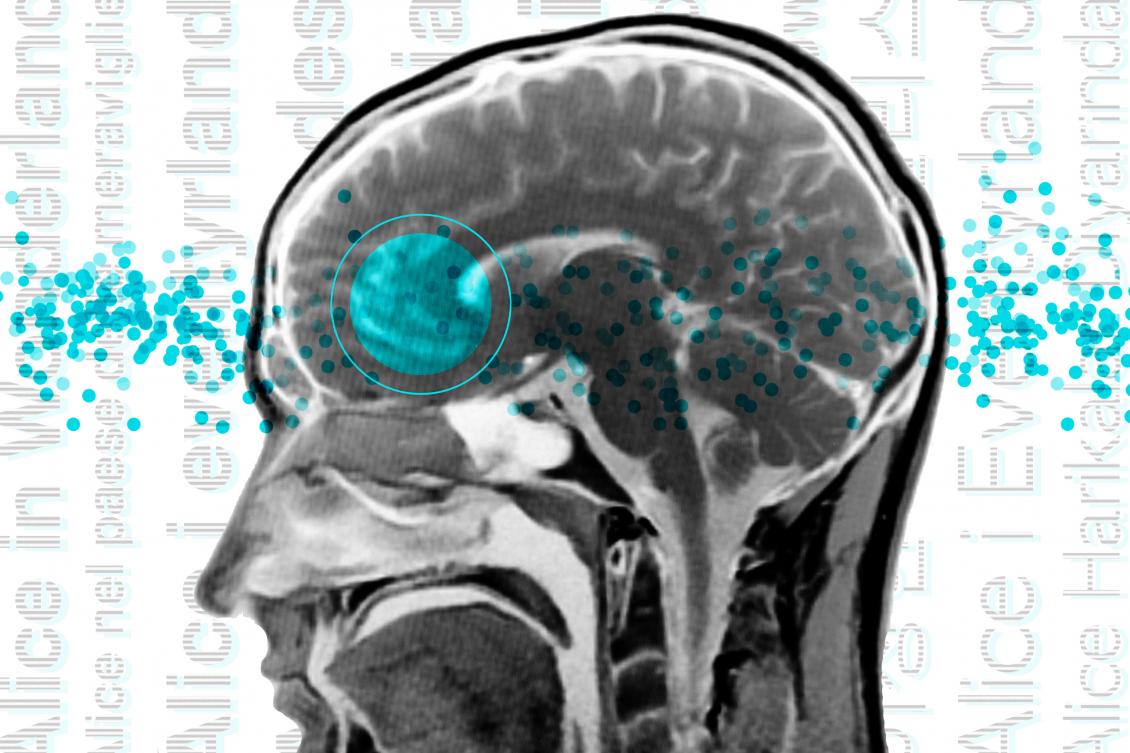 Whether speaking Turkish or Norwegian, the brain’s language network looks the same