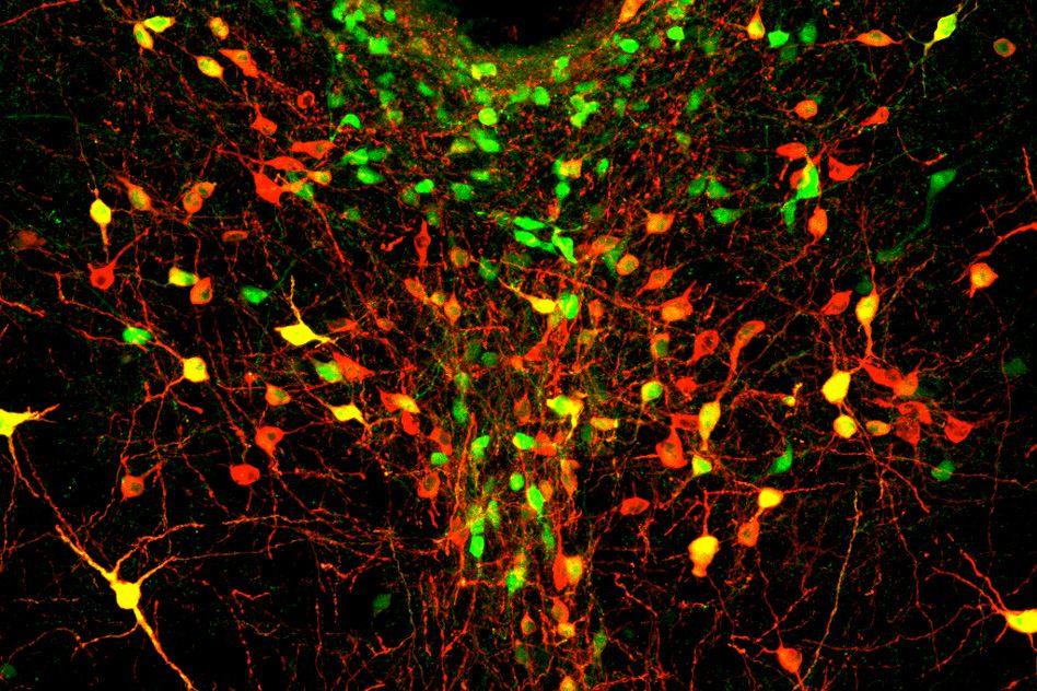 MIT-Lonely-Neurons.jpg MIT-Lonely-Neurons.jpg