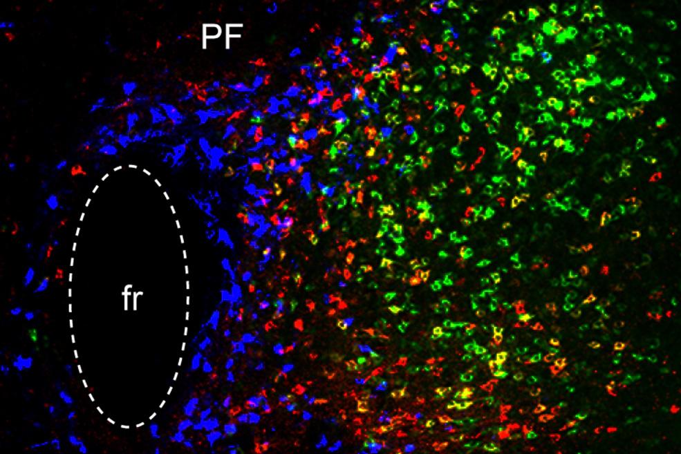 Three distinct brain circuits in the thalamus contribute to Parkinson’s symptoms