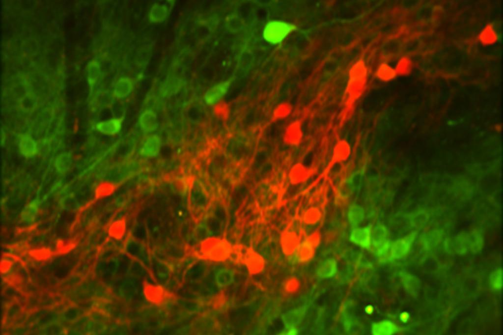 Study finds neurons that encode the outcomes of actions Study finds neurons that encode the outcomes of actions