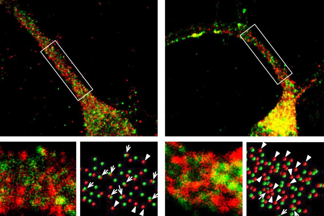 Scientists discover how mutations in a language gene produce speech deficits