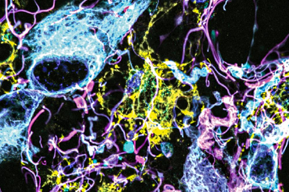 Imaging method reveals new cells and structures in human brain tissue Imaging method reveals new cells and structures in human brain tissue