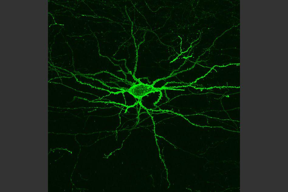 MIT-Voltage-Imaging.jpg MIT-Voltage-Imaging.jpg