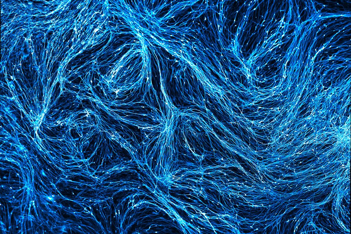 How microglia contribute to Alzheimer’s disease How microglia contribute to Alzheimer’s disease